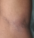 Underarms Wax