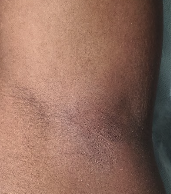 Underarms Wax